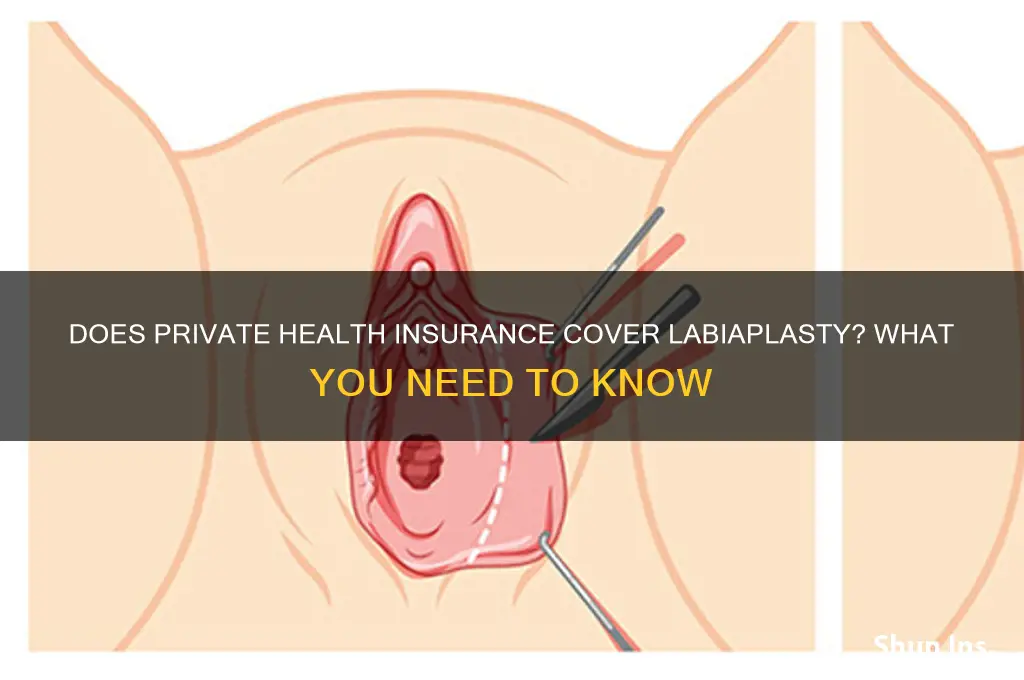 does private health insurance cover labiaplasty