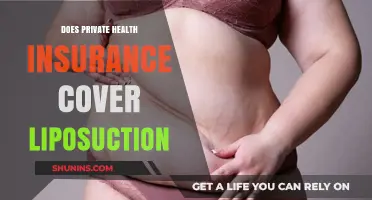 Does Private Health Insurance Cover Liposuction? What You Need to Know