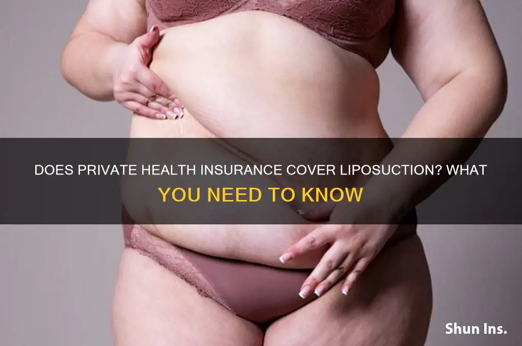 does private health insurance cover liposuction