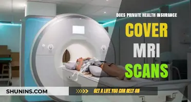 Does Private Health Insurance Cover MRI Scans? What You Need to Know