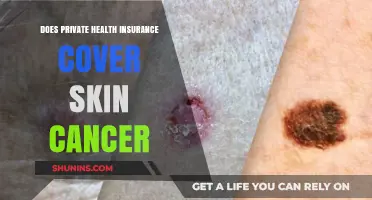 Does Private Health Insurance Cover Skin Cancer Treatment?