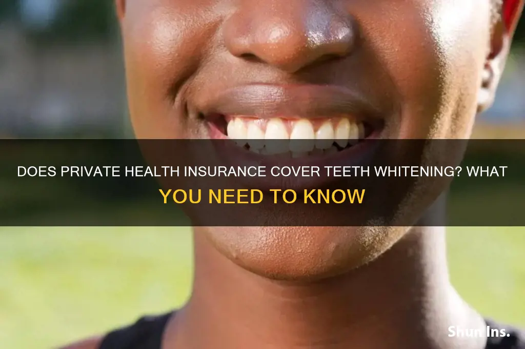 does private health insurance cover teeth whitening