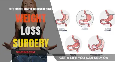 Private Health Insurance Coverage for Weight Loss Surgery: What’s Included?