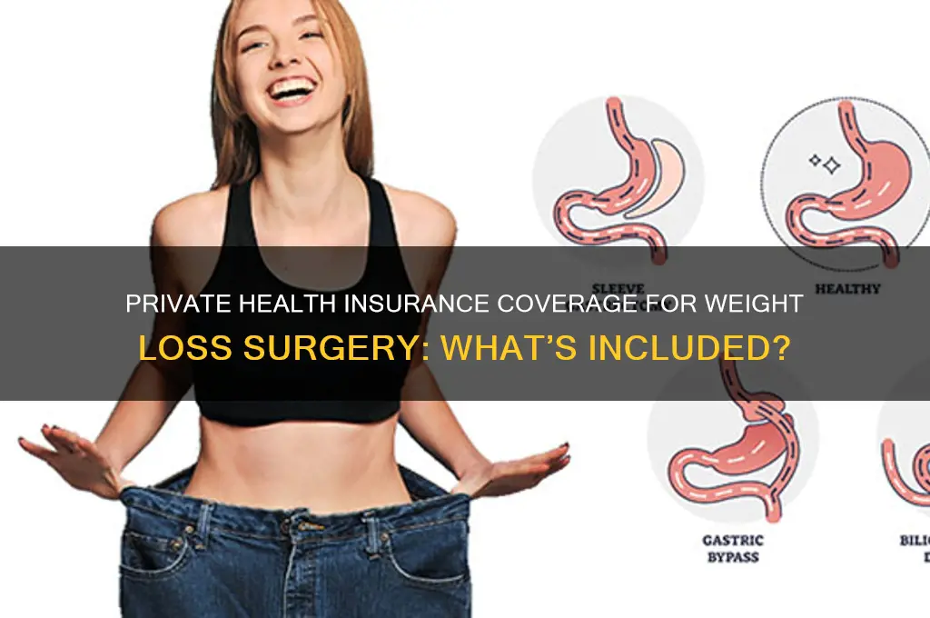 does private health insurance cover weight loss surgery
