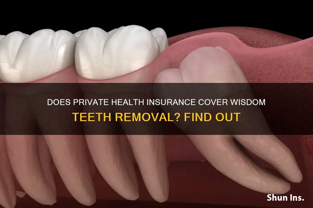 does private health insurance cover wisdom teeth