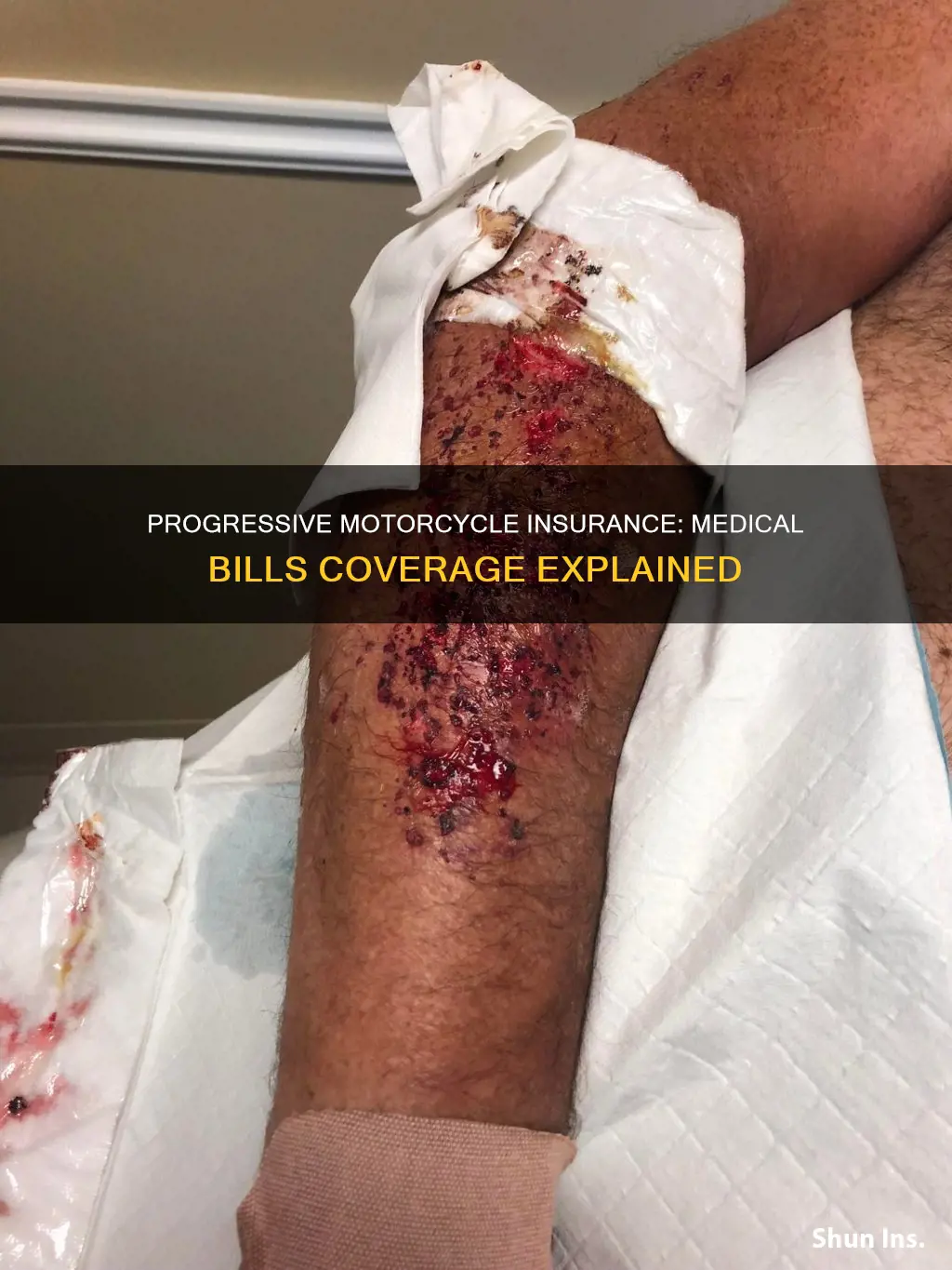 does progressive motorcycle insurance cover medical bills