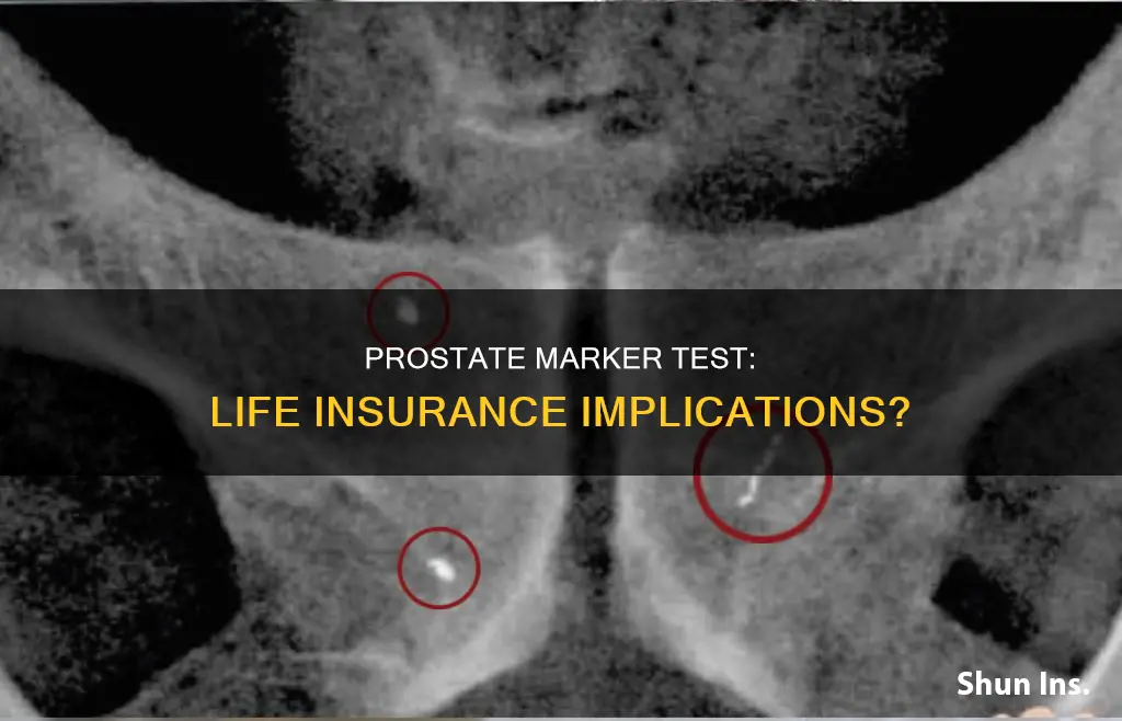 does prostate marker test ban you from life insurance