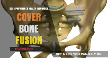 Providence Health Insurance Coverage for Bone Fusion: What You Need to Know