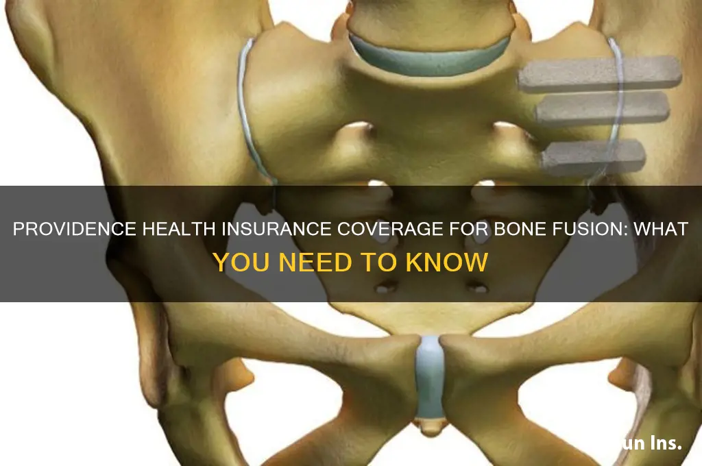 does providence health insurance cover bone fusion