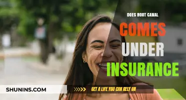 Root Canal Insurance Coverage: What You Need to Know