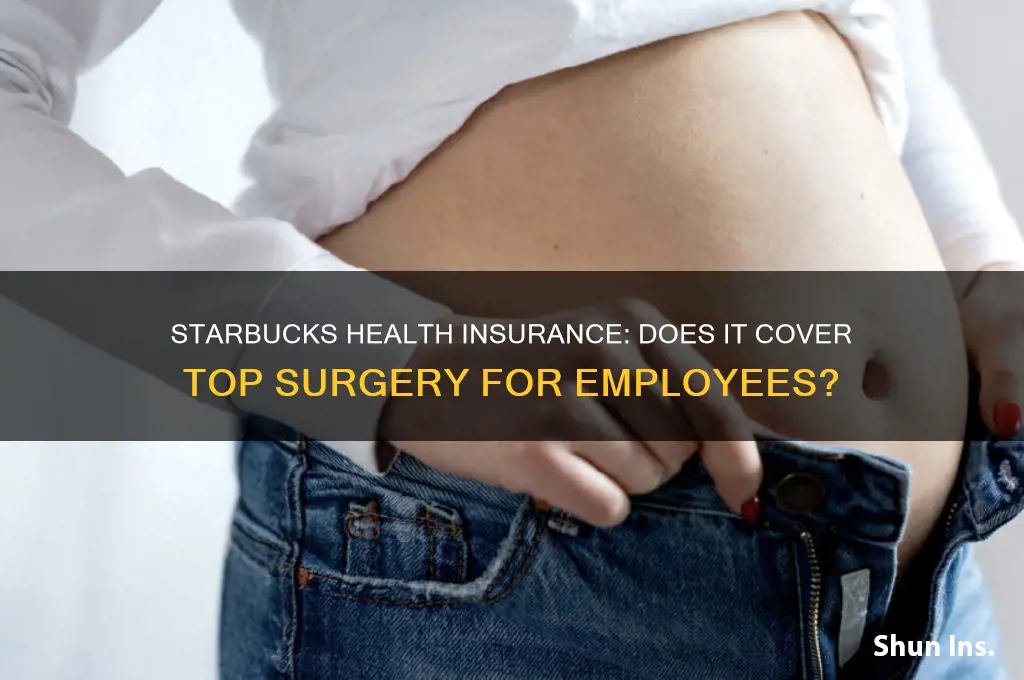 does starbucks health insurance cover top surgery