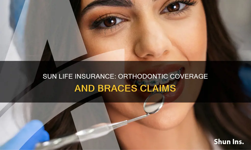 does sun life insurance cover braces