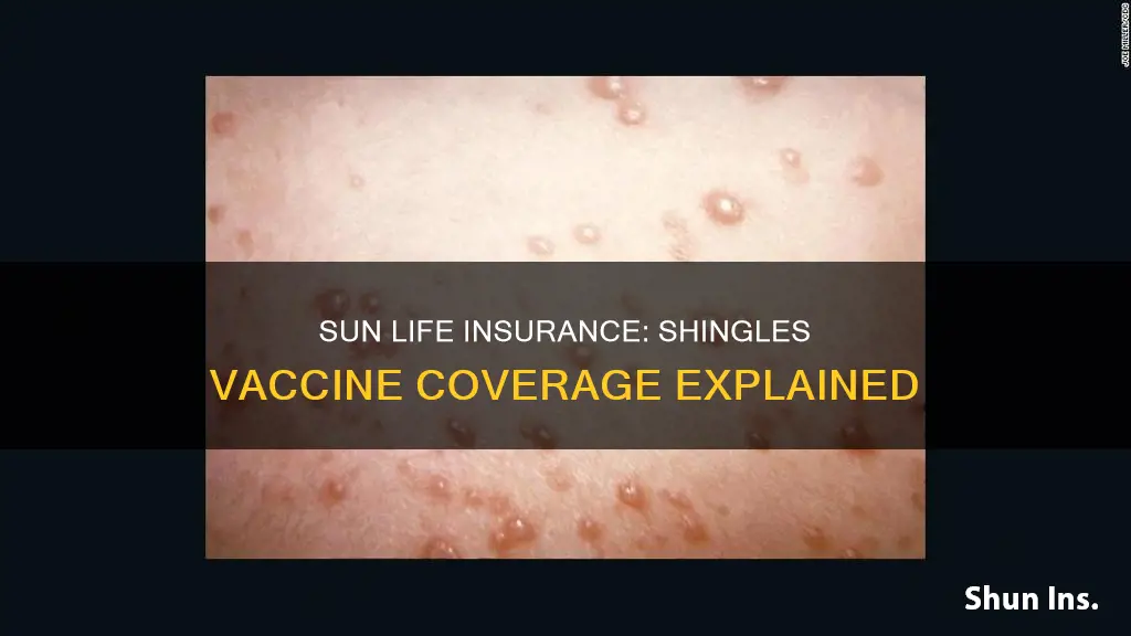 does sun life insurance cover shingles vaccine