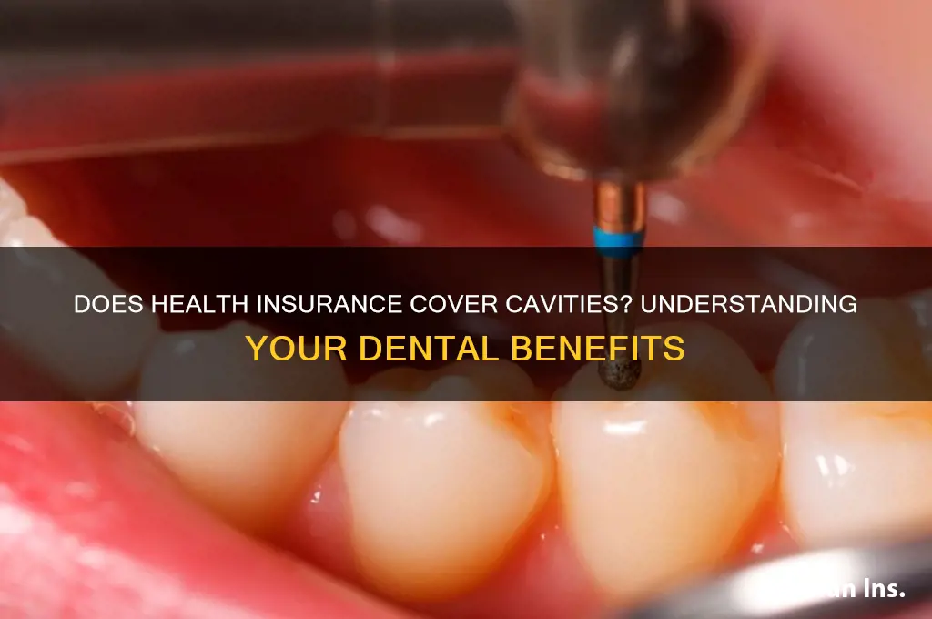 does the health insurance cover cavities