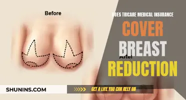 Breast Reduction Surgery: Is Tricare Coverage an Option?