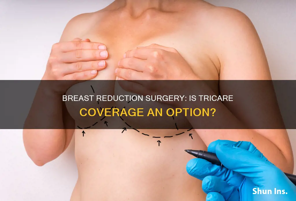 does tricare medical insurance cover breast reduction