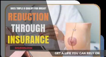 Does Triple D Cup Size Qualify for Insurance-Covered Breast Reduction?