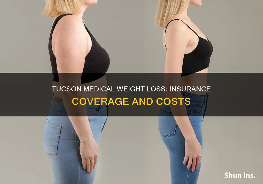 does tucson medical weight loss take insurance