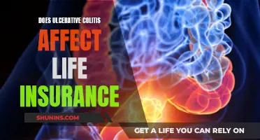 Ulcerative Colitis: Life Insurance Considerations and Impacts