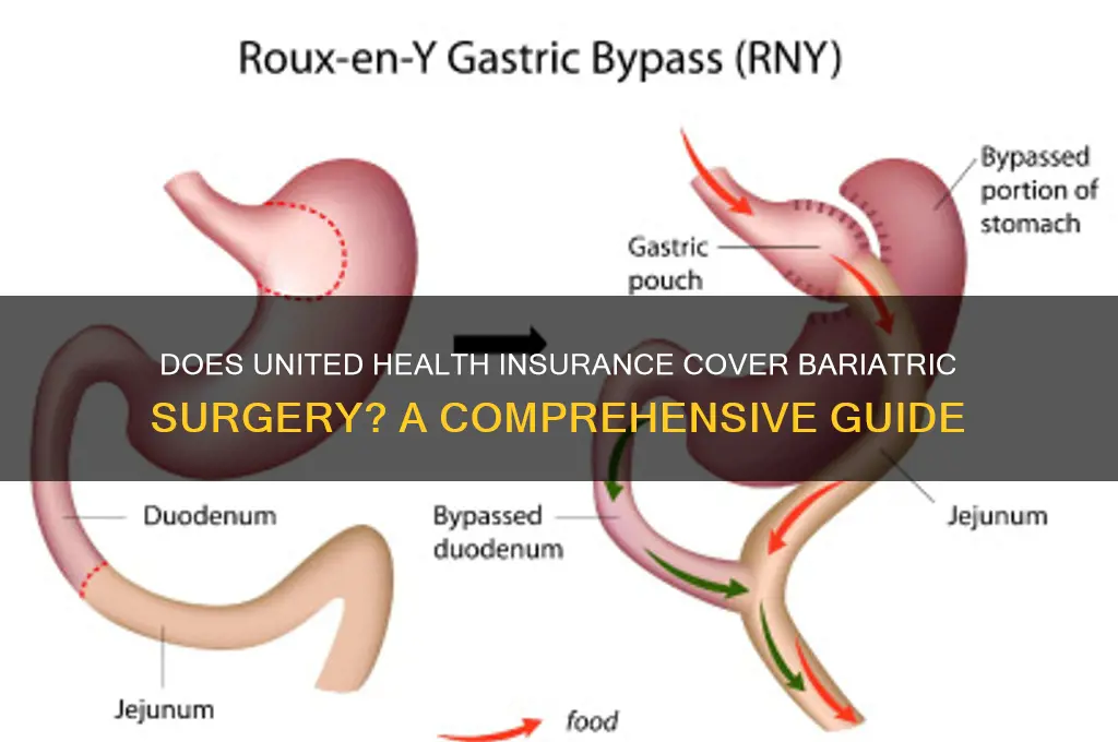 does united health insurance cover bariatric surgery