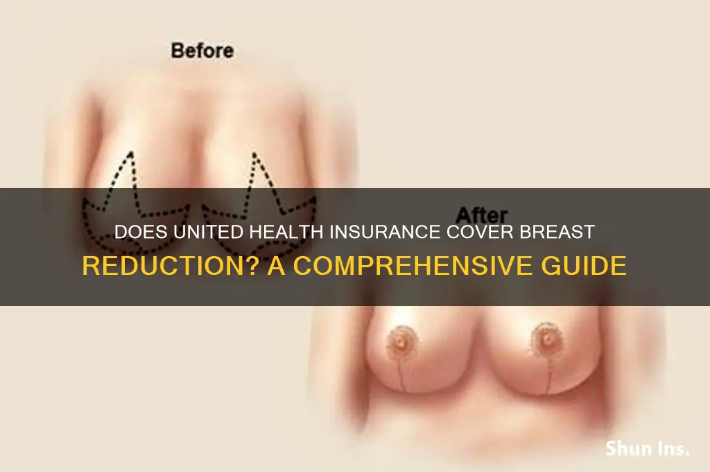 does united health insurance cover breast reduction