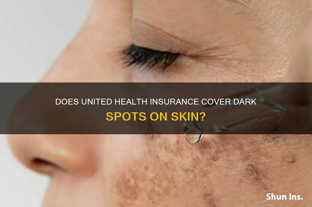does united health insurance cover dark spotson skin