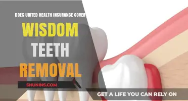 Does United Health Insurance Cover Wisdom Teeth Removal?