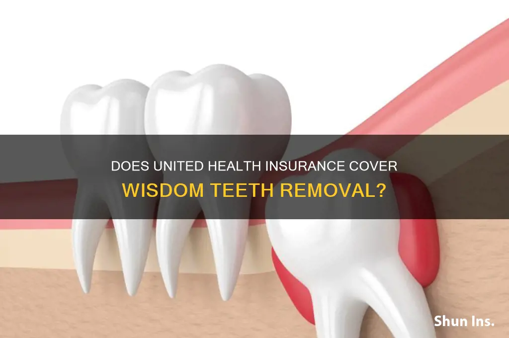 does united health insurance cover wisdom teeth removal