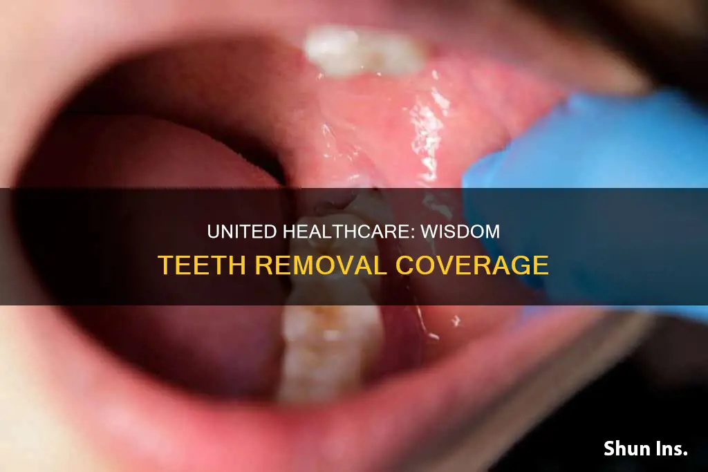 does united healthcare medical insurance cover wisdom teeth removal