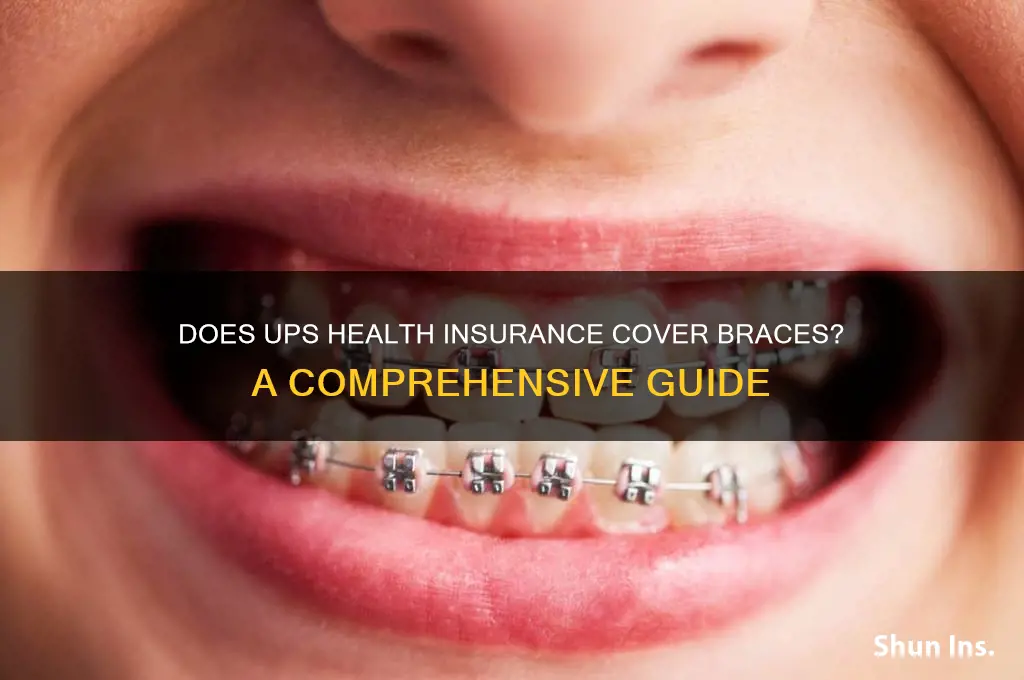 does ups health insurance cover braces