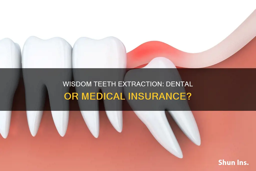 does wisdom teeth extraction fall under dental or medical insurance