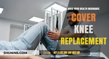 Is Knee Replacement Surgery Covered by Your Health Insurance?