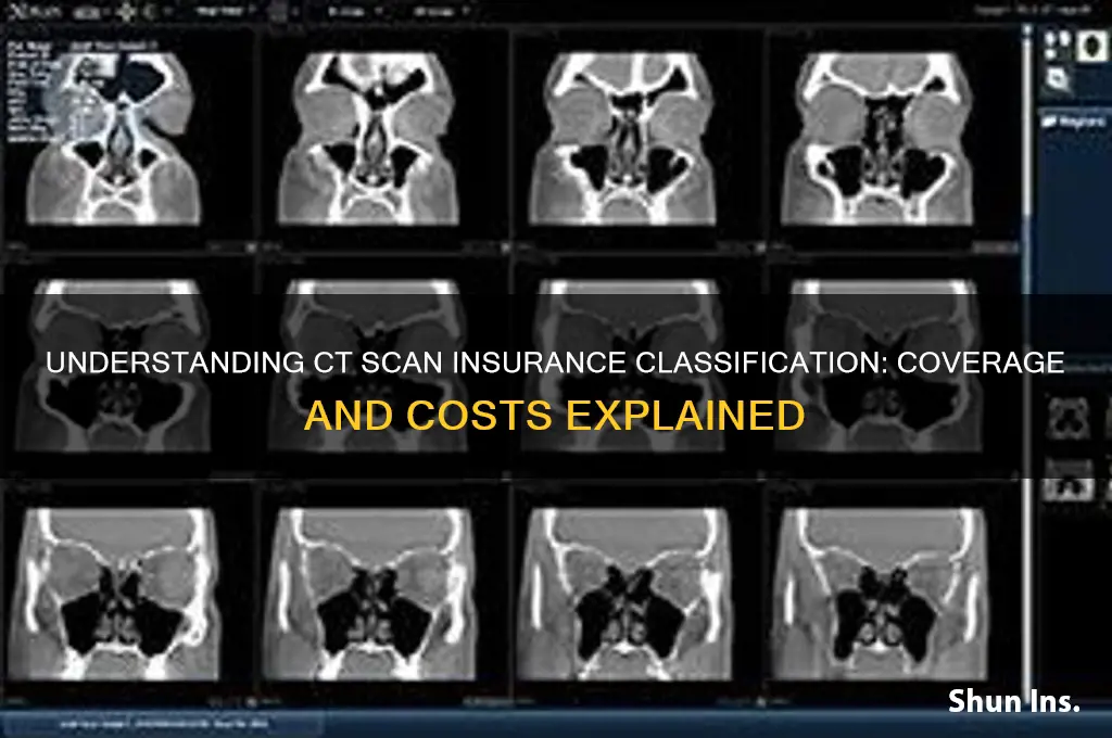 how a ct scan is classified under insurance