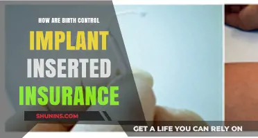 Birth Control Implant Insertion: Insurance Coverage and Procedure Explained