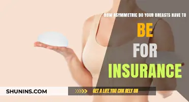 Breast Asymmetry and Insurance Coverage: What’s the Threshold?