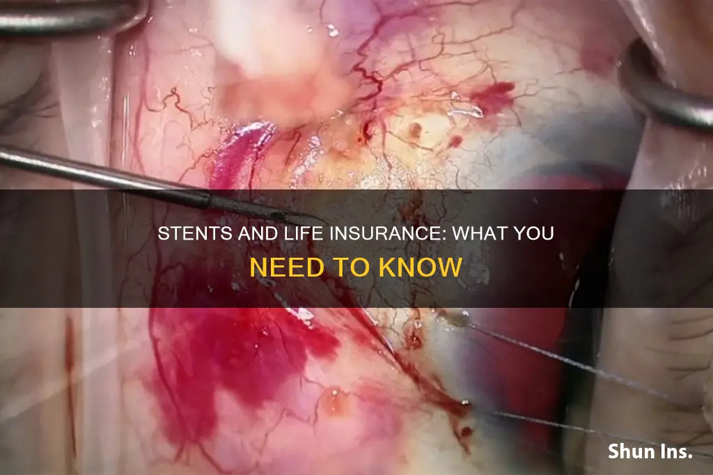 how does having stents affect life insurance