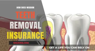 Understanding Wisdom Teeth Removal Insurance Coverage and Costs