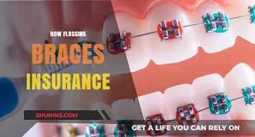 Flossing with Braces: Insurance Tips for Optimal Oral Health