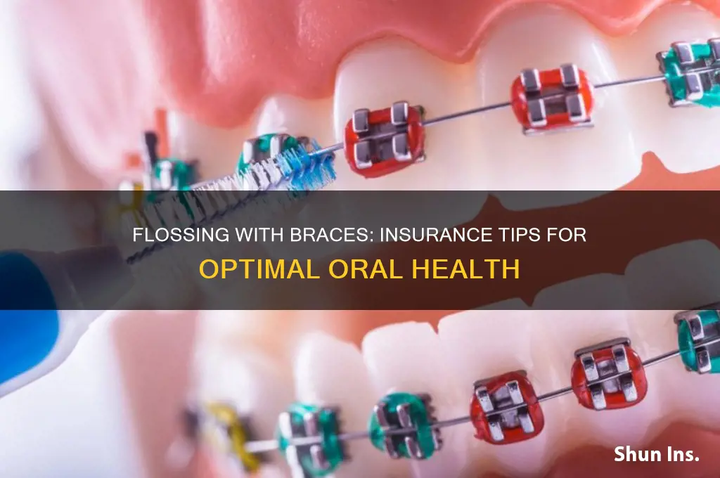 how flossing braces insurance