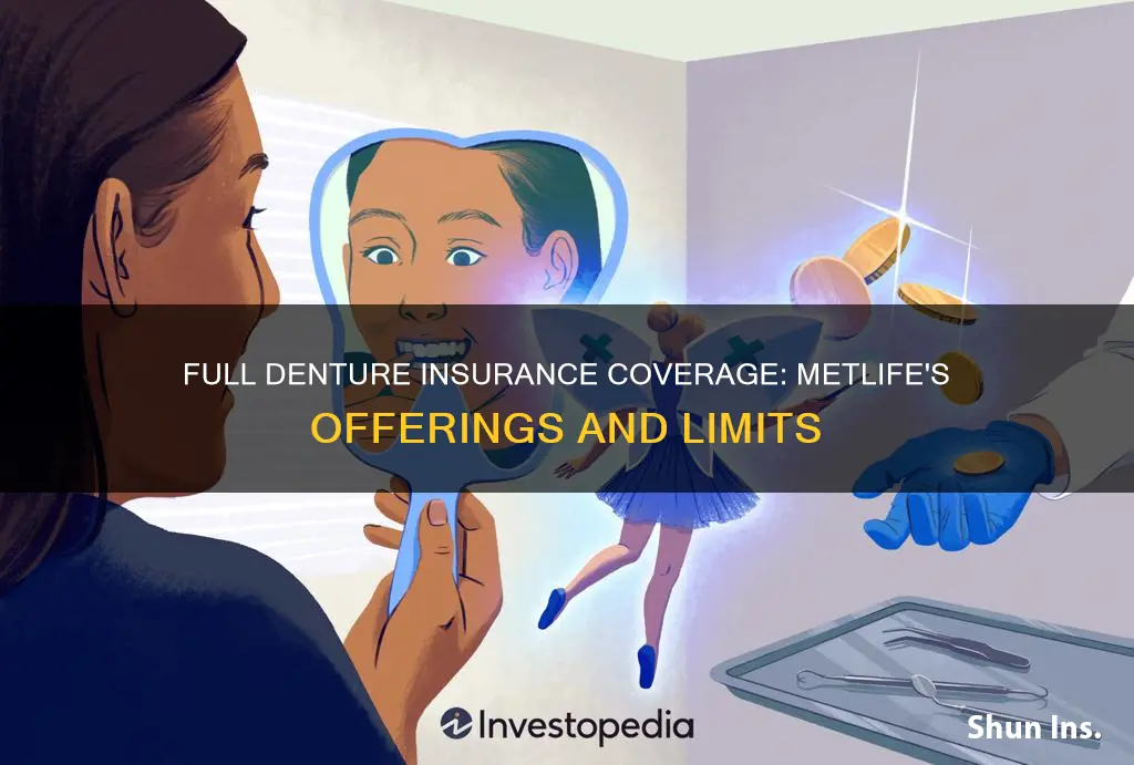 how many full dentures paid the insurance met life