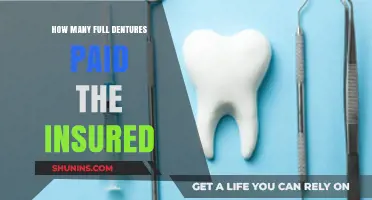 Understanding Full Denture Coverage: How Many Are Paid by Insurance?