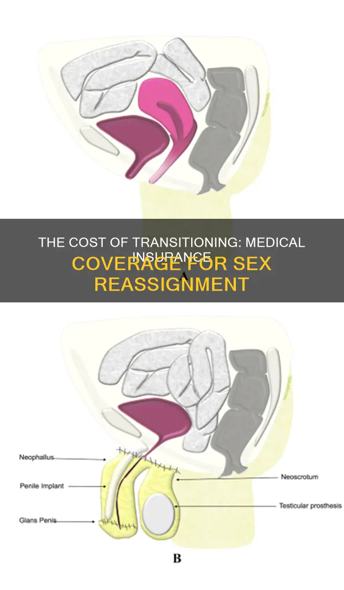 how much for a sex change medical insurance