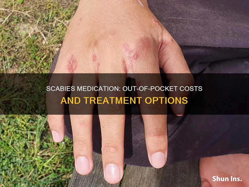 how much is scabies medication without insurance