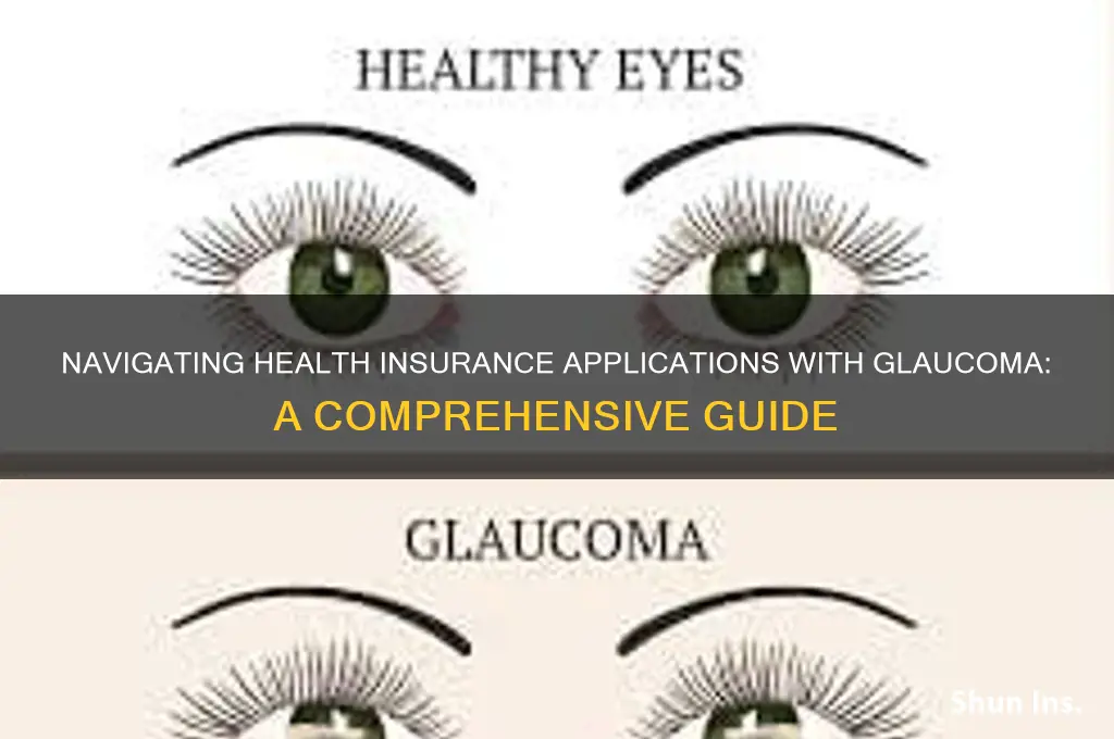 how to apply for health insurance if you have glaucoma