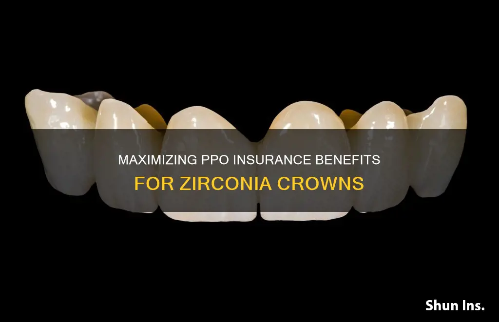 how to bill ppo insurance zirconia crowns