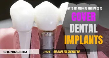 Strategies for Getting Medical Insurance to Cover Dental Implants