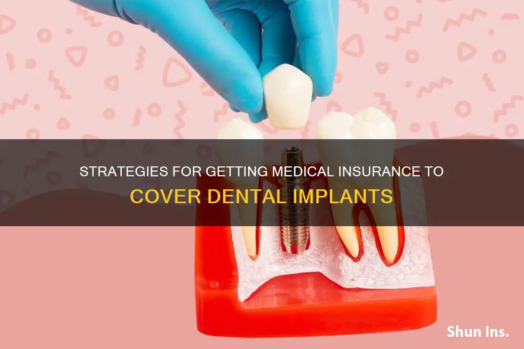 how to get medical insurance to cover dental implants