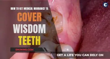 Get Wisdom Teeth Coverage: Understanding Medical Insurance Options
