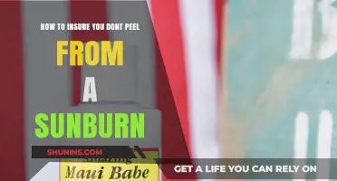 Prevent Sunburn Peeling: Essential Tips for Healthy, Soothed Skin Recovery