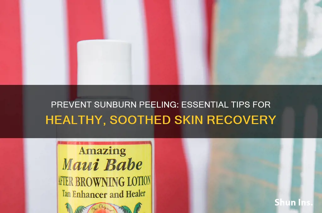 how to insure you dont peel from a sunburn